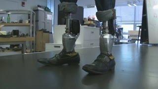 Bionic Limbs